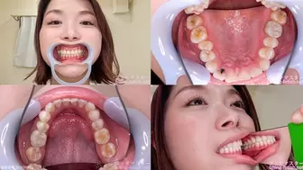 Tsubaki - Watching Inside mouth of Japanese cute girl bite-149-1 - wmv