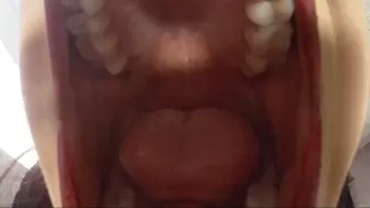 Inside my mouth with gummy bears