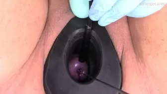 cervix sounding, orgasm with tunnel plug