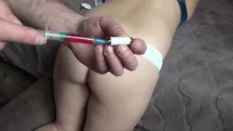two very painful injections close up 2A