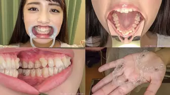 Kanna - Watching Inside mouth of Japanese cute girl - wmv