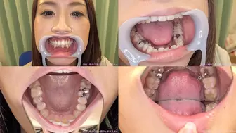 Hana Yoshida - Watching Inside mouth of Japanese beautiful lady - wmv