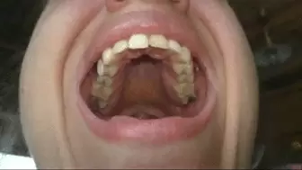 Toothy yawning