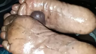 cum on these cracked swollen feet