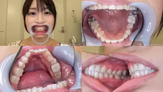 Nozomi - Watching Inside mouth of Japanese pretty lady BITE-41-1 - wmv