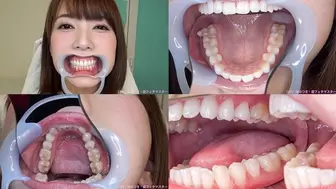 Yui Hatano - Watching Inside mouth of Japanese fascinating lady BITE-44-1 - wmv
