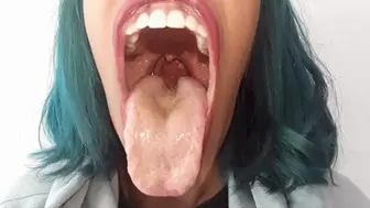 Bad Breath Wet Tongue