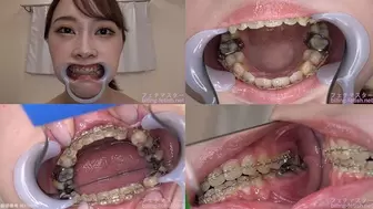 Koyoi - Watching Inside mouth of Japanese cute girl bite-153-1