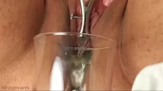 piss spout speculum and sounding