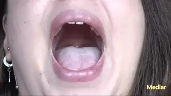 Tongue and uvula [HOPE],