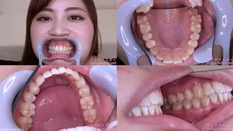 Ayaka- Watching Inside mouth of Japanese cute girl bite-155-1