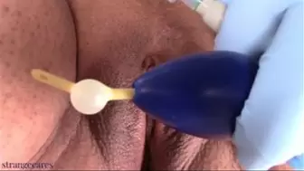 wetting with catheter in urethral plug