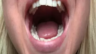 All in extreme super close up of your wonderful teeth A
