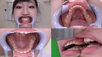 Himari - Watching Inside mouth of Japanese cute girl bite-162-1