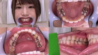 Alice - Watching Inside mouth of Japanese cute girl bite-160-1