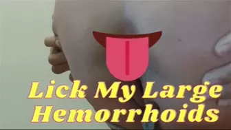 Lick My Large Hemorrhoids!