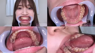 Mitsuha - Watching Inside mouth of Japanese cute girl bite-164-1