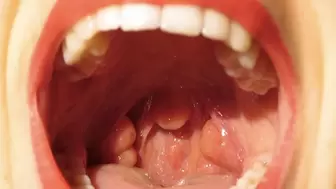 Close up uvula