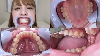 Nina - Watching Inside mouth of Japanese cute girl bite-165-1