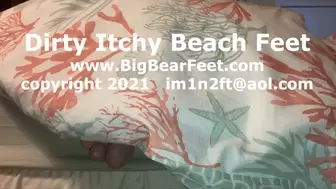 Dirty Itchy Beach Feet - dirty and itchy from being on the beach all day