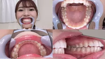 Riri - Watching Inside mouth of Japanese cute girl bite-167-1