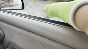 Airing out my short arm cast in the car window