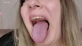 Daisy's Bumpy Thrush Tongue *HD