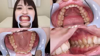 Satori - Watching Inside mouth of Japanese cute girl bite-172-1 - wmv