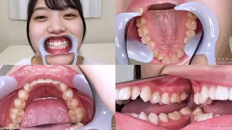 Maina - Watching Inside mouth of Japanese cute girl bite-173-1