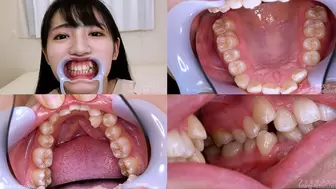 Ai - Watching Inside mouth of Japanese cute girl bite-174 - wmv