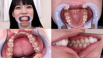 Shizuku - Watching Inside mouth of Japanese cute girl bite-176-1
