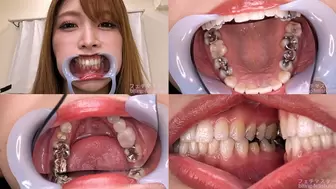 Akari - Watching Inside mouth of Japanese cute girl bite-177-1