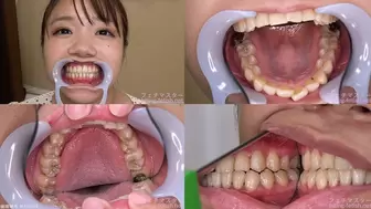 Mei - Watching Inside mouth of Japanese cute girl bite-178-1