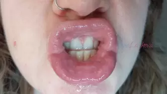 Angry teeth, spit, and bubbles round 2