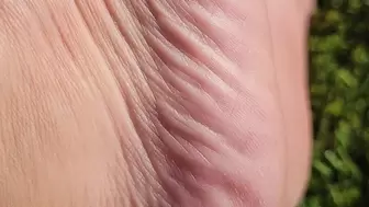 Side foot wrinkles
