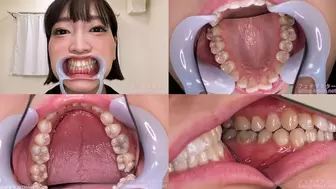 Ameri - Watching Inside mouth of Japanese cute girl bite-179-1