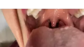 are you sure you want to pass my uvula?