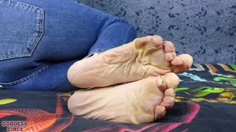 MY TERRIBLE FEET: CALLUSES AND DRY HEELS 2