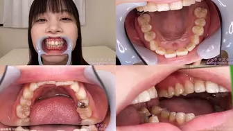 Ayami - Watching Inside mouth of Japanese cute girl bite-181-1