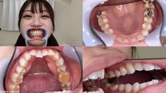 Ichika - Watching Inside mouth of Japanese cute girl bite-183-1