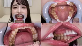 Yuzu - Watching Inside mouth of Japanese cute girl bite-182-1