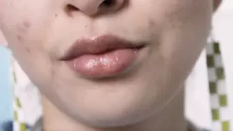 Aurora Smacks Her Lips With Lip Gloss