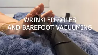 WRINKLED SOLES AND BAREFOOT VACUUMING