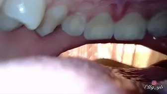 Reverse endoscope mouth tour