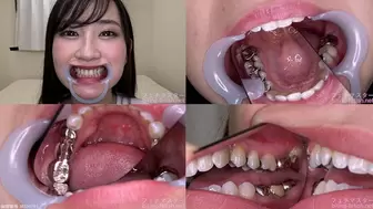 Hina - Watching Inside mouth of Japanese cute girl bite-185-1