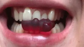 Bears in the teeth