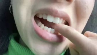 Aurora's Teeth Bite Herself
