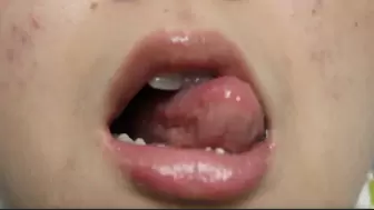 Aurora's Tongue Spills Saliva