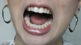 Aurora's Superb Teeth Adventures