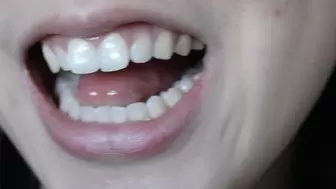 Aurora Has Pretty Teeth